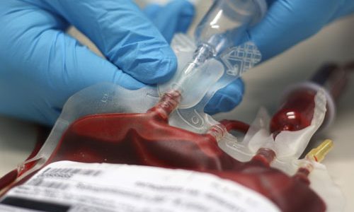 AUTOLOGOUS BLOOD TRANSFUSION