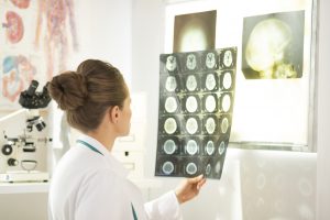 Benign Neurological
