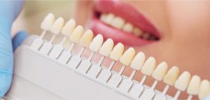 Best dental hospital in Delhi, India - Venkateshwar Hospital