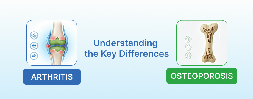 Arthritis vs Osteoporosis: Understanding the Key Differences