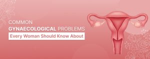 Common Gynaecological Problems Every Woman Should Know About