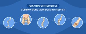 Pediatric Orthopaedics: Common Bone Disorders in Children