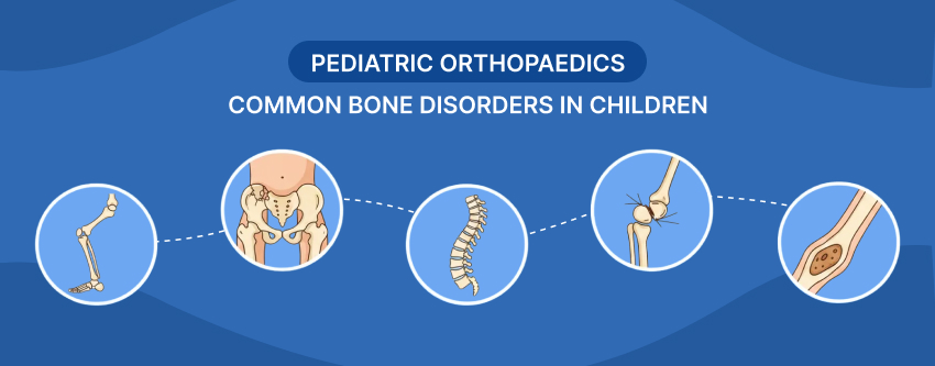 Pediatric Orthopaedics: Common Bone Disorders in Children