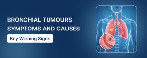 Bronchial Tumours Symptoms and Causes