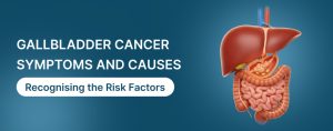 Gallbladder Cancer Symptoms and Causes