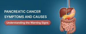 Pancreatic Cancer Symptoms and Causes