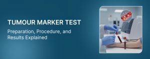 Tumour Marker Test