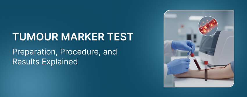 Tumour Marker Test