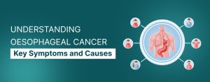 Oesophageal Cancer Symptoms and Causes