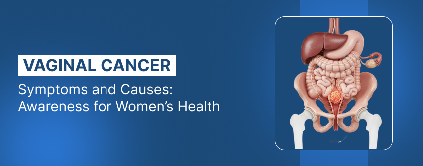 Vaginal Cancer Symptoms and Causes