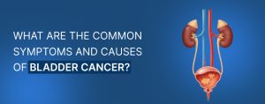 Symptoms and Causes of Bladder Cancer