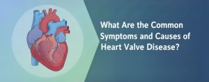 Symptoms and Causes of Heart Valve Disease