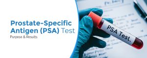 Prostate-Specific Antigen (PSA) Test