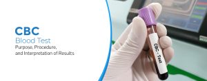 CBC Blood Test