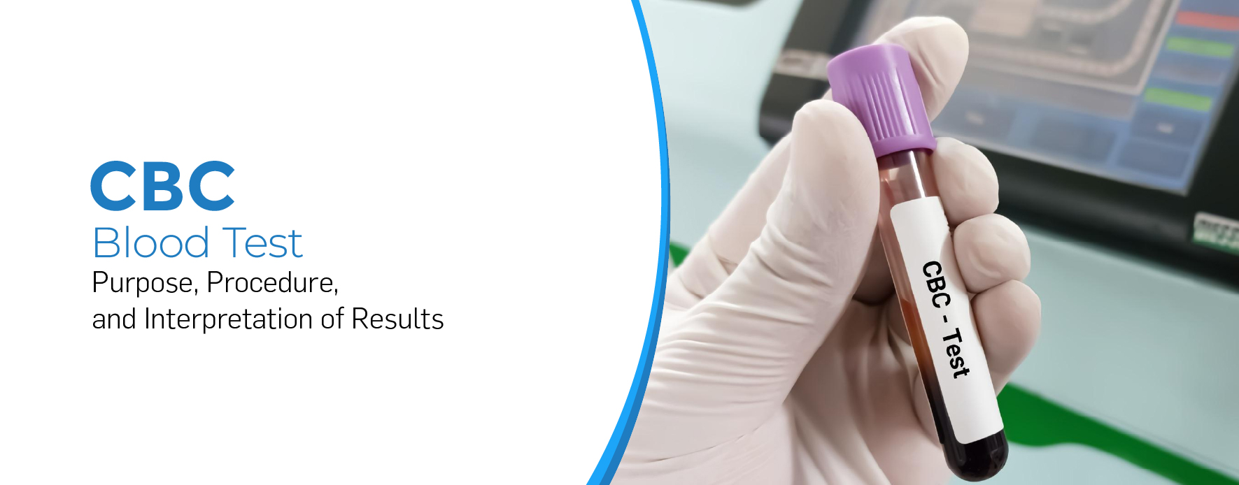 CBC Blood Test: Purpose, Procedure, and Interpretation of Results - Venkateshwar Hospital