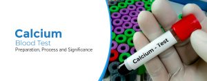 Calcium Blood Test
