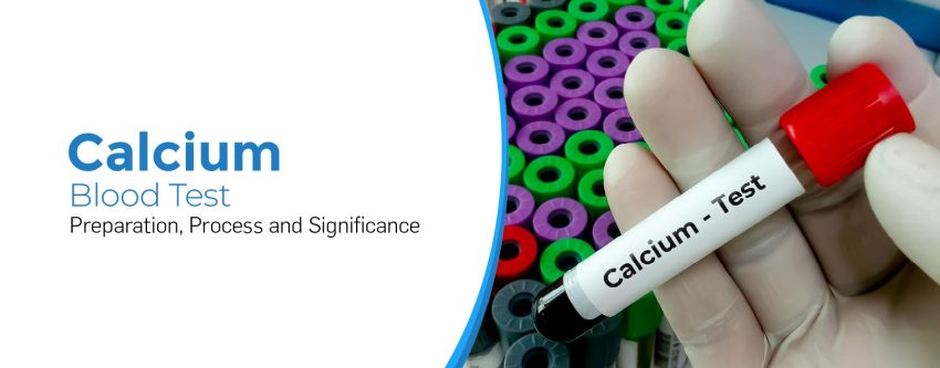 Calcium Blood Test