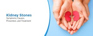 Kidney Stones: Symptoms, Causes, Prevention, and Treatment