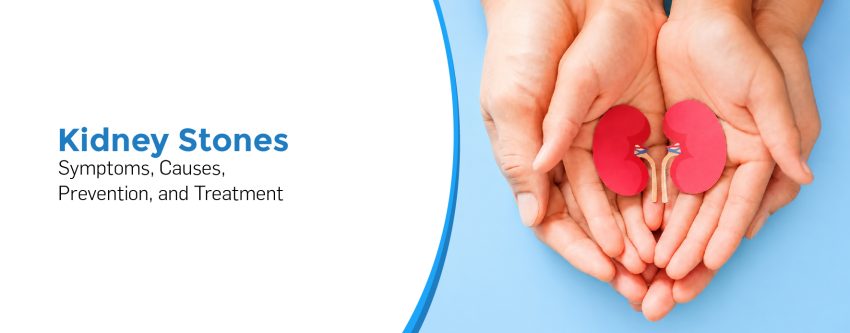 Kidney Stones: Symptoms, Causes, Prevention, and Treatment