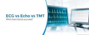 ECG vs Echo vs TMT: Which Heart Test Do You Need?