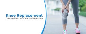 Knee Replacement: Common Myths and Facts You Should Know