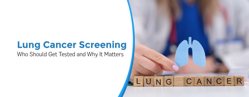 Lung Cancer Screening: Who Should Get Tested and Why It Matters