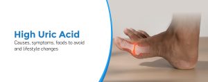 High Uric Acid: Causes, Symptoms, Foods to Avoid and Lifestyle Changes