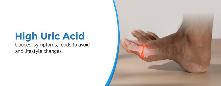 High Uric Acid: Causes, Symptoms, Foods to Avoid and Lifestyle Changes