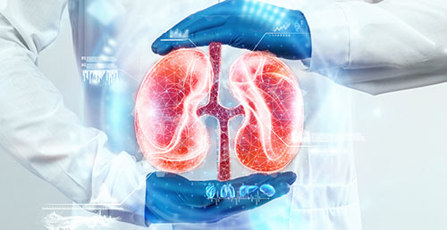 Kidney Transplant Pic