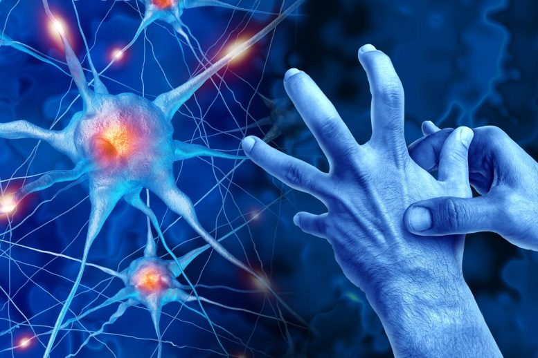 Parkinson's Disease